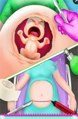 孕妇手术模拟
